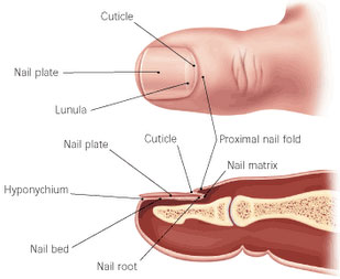 You can have your nail completely removed (this is called avulsion) or